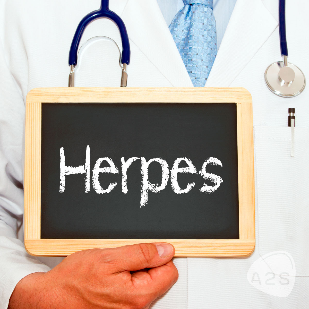 herpes genitale